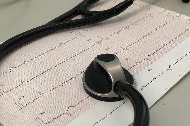 Cardiac - ECG